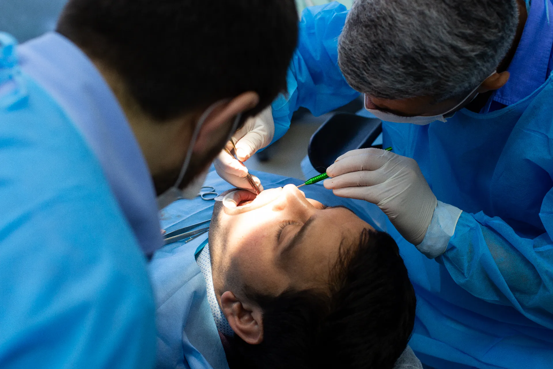 Implantes Zigomáticos