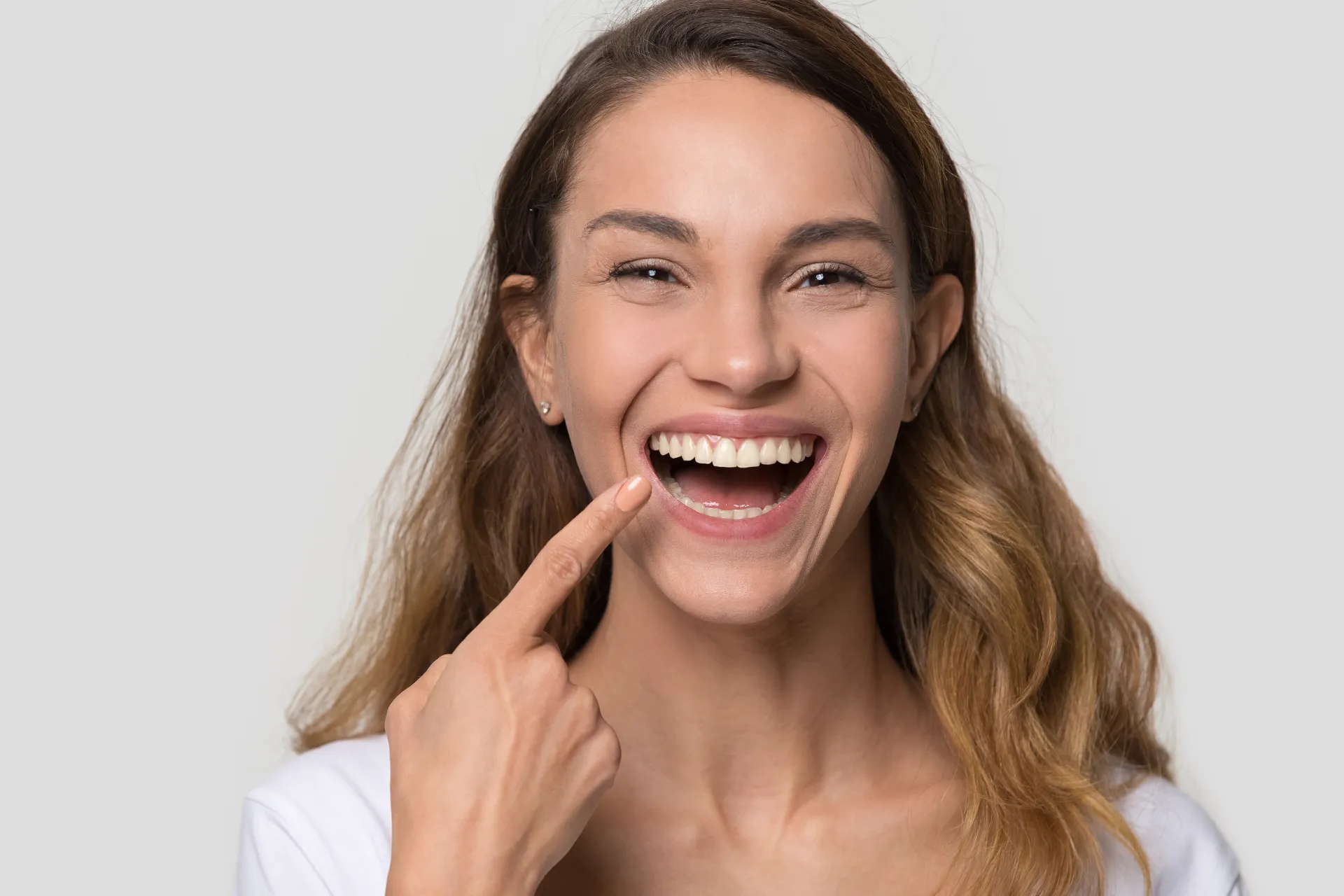 Implantes Dentários